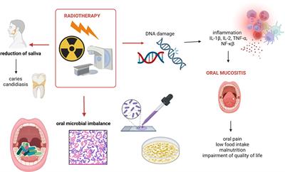 Anti-cancer management of head and neck cancers and oral microbiome—what can we clinically obtain?